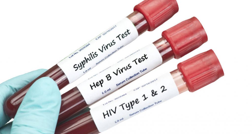 Why are STD Tests Important?