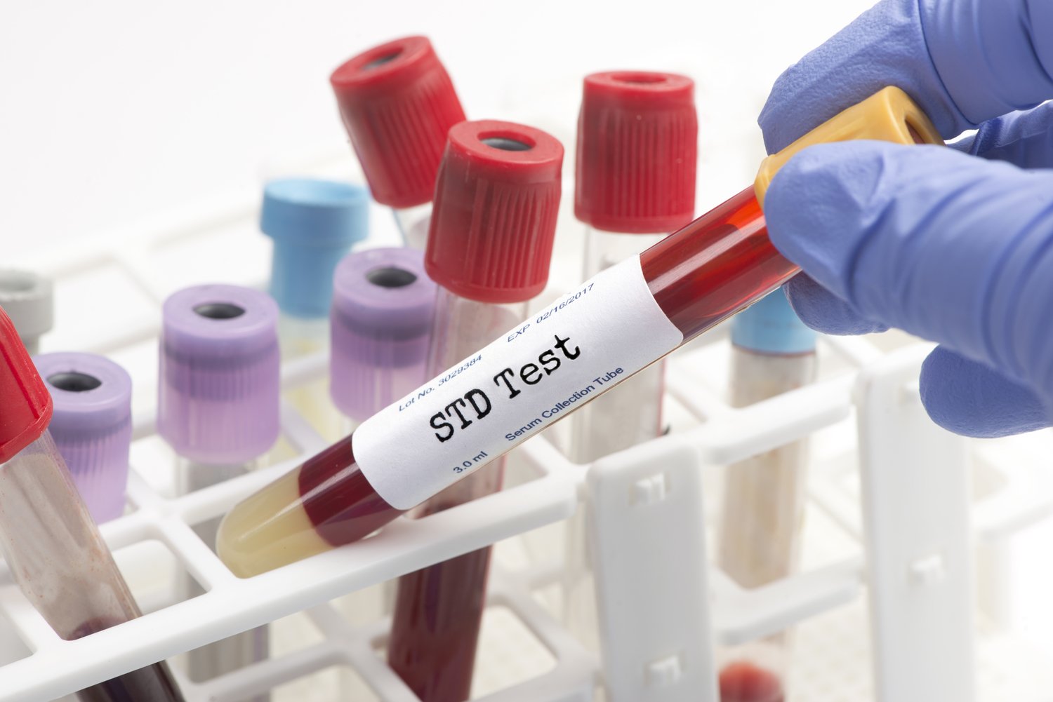 Why Use an in Home STD Test Kit?